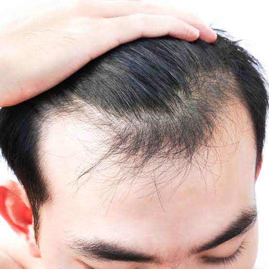 Stress and Hair Fall: What’s the Real Link?